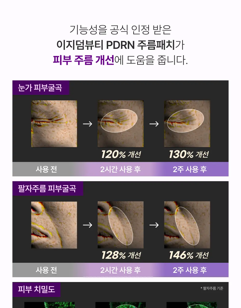 [3배UP/EGF+콜라겐] 이지덤 PDRN 주름패치 마이크로 700샷 4매 상세페이지 17